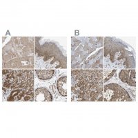 Anti-GCN1 antibody produced in rabbit HPA019648-100UL