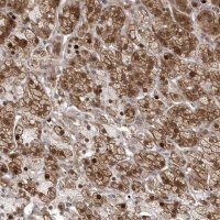 Anti-GEMIN6 antibody produced in rabbit 