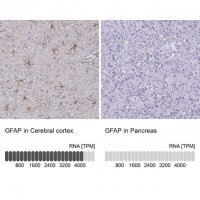 Anti-GFAP antibody produced in rabbit HPA056030-100UL