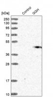 Anti-GGH antibody produced in rabbit 
