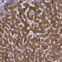 Anti-GHR antibody produced in rabbit