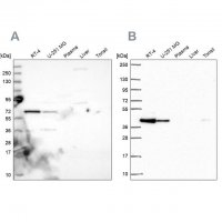 Anti-GIPC1 antibody produced in rabbit 
