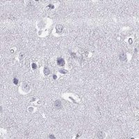 Anti-GJA8 antibody produced in rabbit