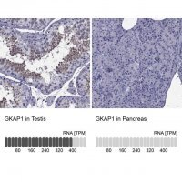 Anti-GKAP1 