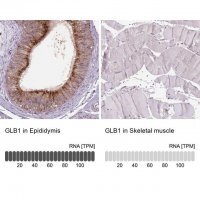Anti-GLB1 antibody produced in rabbit