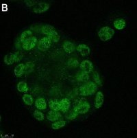 Anti-GLS2 Antibody, clone 3G12 ZooMAb� Rabbit Monoclonal 