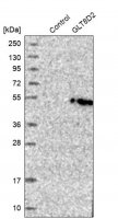 Anti-GLT8D2 antibody produced in rabbit 