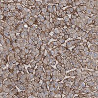 Anti-GLT8D2 antibody produced in rabbit 