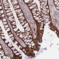 Anti-GLTP antibody produced in rabbit 