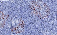 Anti-Glucagon Antibody, clone 6D6 ZooMAb� Rabbit Monoclonal 