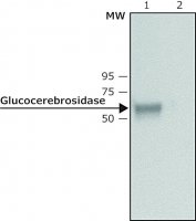 Anti-Glucocerebrosidase antibody produced in rabbit
