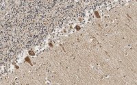 Anti-GluR-2 Antibody, clone 1K20 ZooMAb� Rabbit Monoclonal 