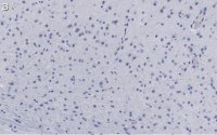 Anti-GluR1 Antibody, clone RH95 ZooMAb® Mouse Monoclonal