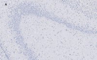 Anti-GluR2 Antibody, clone 1K4, ZooMAb� Rabbit Monoclonal 