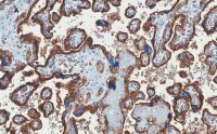 Anti-GLUT-1 Antibody, CT, clone 16D21, ZooMAb� Rabbit Monoclonal 