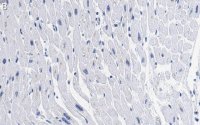 Anti-GLUT-4 Antibody, clone 1M13 ZooMAb� Rabbit Monoclonal 