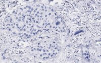 Anti-Glypican-1 Antibody, clone 1J4, ZooMAb� Rabbit Monoclonal 