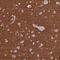 Anti-GNAO1 antibody produced in rabbit 