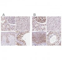 Anti-GNL3 antibody produced in rabbit 