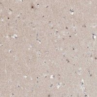 Anti-GNL3L antibody produced in rabbit 