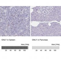 Anti-GNLY antibody produced in rabbit