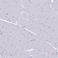 Anti-GNLY antibody produced in rabbit