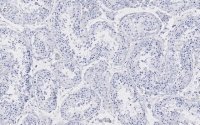 Anti-Golgin-97 Antibody, clone 4K16, ZooMAb� Rabbit Monoclonal 
