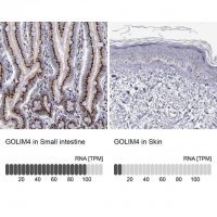 Anti-GOLIM4 antibody produced in rabbit 