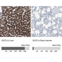 Anti-GOT2 antibody produced in rabbit 