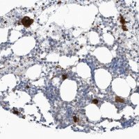 Anti-GPATCH3 antibody produced in rabbit