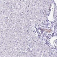 Anti-GPBAR1 antibody produced in rabbit