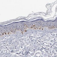 Anti-GPR143 antibody produced in rabbit 