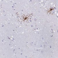 Anti-GPR17 antibody produced in rabbit 