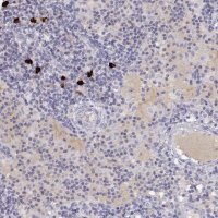 Anti-GPR174 antibody produced in rabbit 