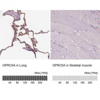 Anti-GPRC5A antibody produced in rabbit 