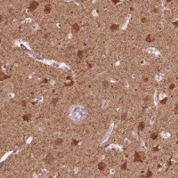 Anti-GPRIN1 antibody produced in rabbit