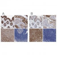 Anti-GPT antibody produced in rabbit 