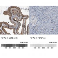 Anti-GPX2 antibody produced in rabbit 