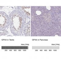 Anti-GPX4 antibody produced in rabbit