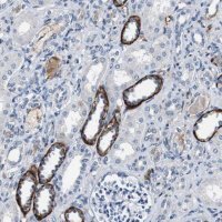 Anti-GRAMD1A antibody produced in rabbit