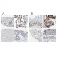 Anti-GRHL1 antibody produced in rabbit