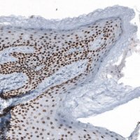 Anti-GRHL2 antibody produced in rabbit