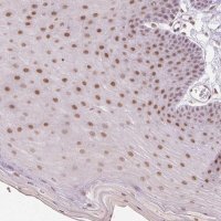 Anti-GRHL3 antibody produced in rabbit 