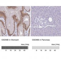 Anti-GSDMB antibody produced in rabbit