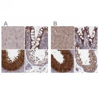 Anti-GSS antibody produced in rabbit HPA059315-100UL