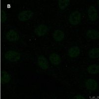 Anti-GST Antibody, clone 5B8 , ZooMAb� Rabbit Monoclonal 