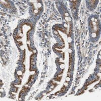 Anti-GSTK1 antibody produced in rabbit 