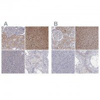Anti-GSTO1 antibody produced in rabbit 