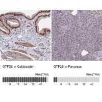 Anti-GTF2B antibody produced in rabbit 