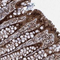 Anti-GTF2F1 antibody produced in rabbit